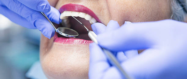 Best Cracked Tooth Emergency Dentist  in Allyn, WA